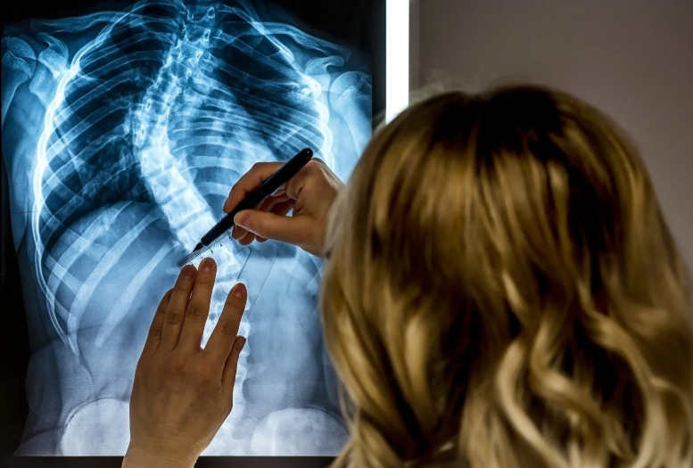 scoliosis diagnosis