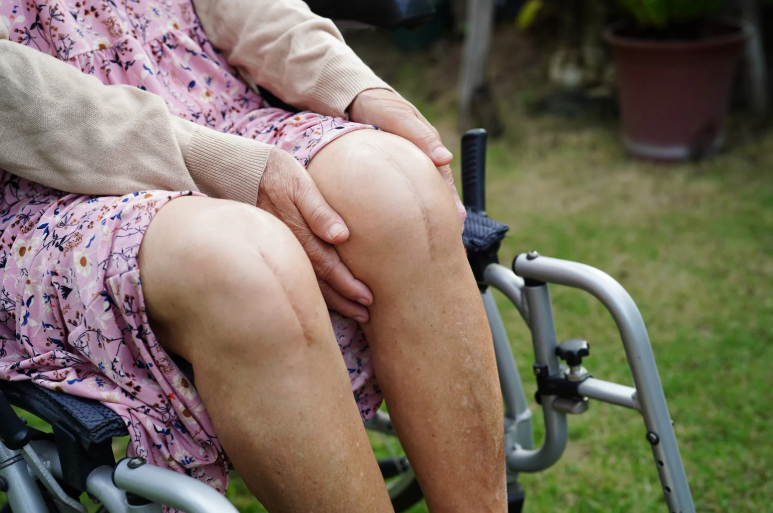 38) How Physiotherapy Helps After Knee Replacement Surgery
