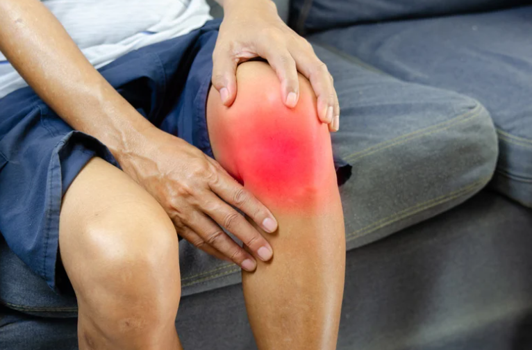 54) Fat Pad Impingement with Physiotherapy