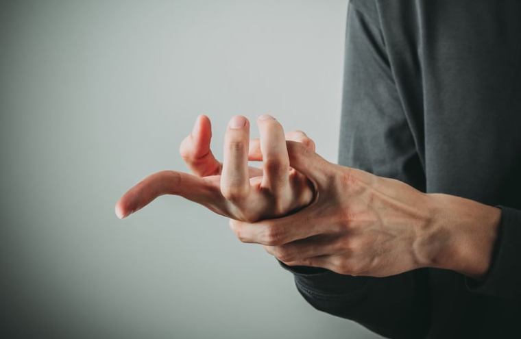 49) Finger Fracture Recovery with Physiotherapy