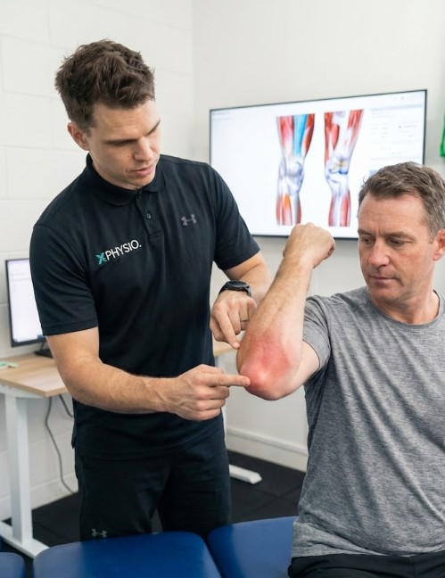 79) Elbow Bursitis or Tennis Elbow? How to Tell and When to See a Physio